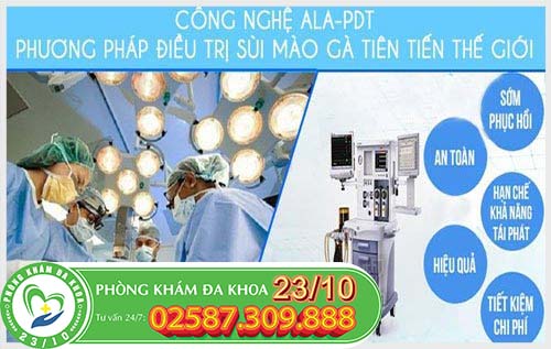 hỗ trợ điều trị sùi mào gà bằng phương pháp ALA-PDT hỗ trợ điều trị sùi mào gà bằng phương pháp ALA-PDT
