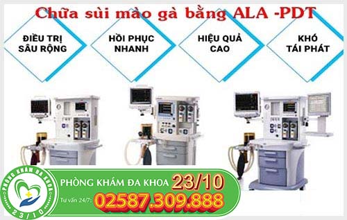 Ưu điểm phương pháp ALA-PDT trong việc hỗ trợ điều trị sùi mào gà Ưu điểm phương pháp ALA-PDT trong việc hỗ trợ điều trị sùi mào gà