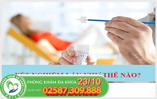 Xét nghiệm bệnh lậu bằng phương pháp nào? Xét nghiệm bệnh lậu bằng phương pháp nào?