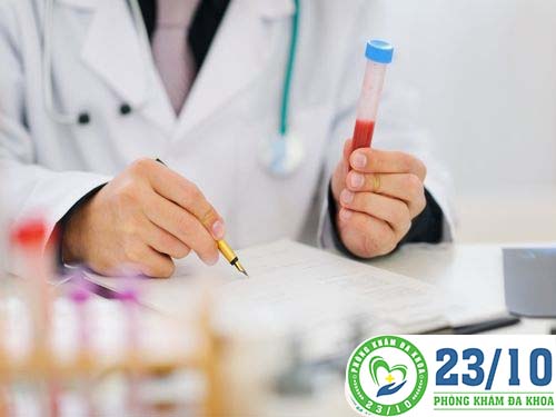 Xét nghiệm  HSV mụn rộp sinh dục